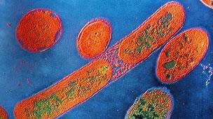 Pseudomonas aeruginosa is a relatively common type of infection encountered in UK hospitals