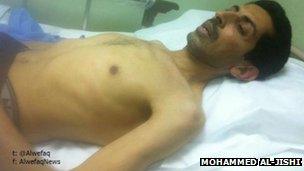 Abdulhadi al-Khawaja in hospital (3 April 2012)