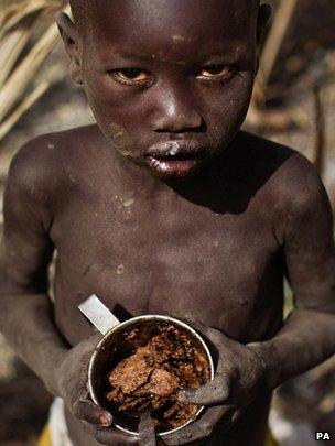 Starving African boy