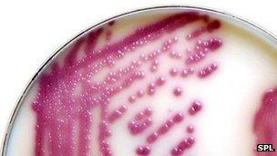 E. coli