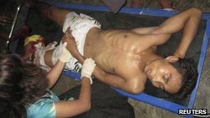 Injured people are treated in Sittwe General Hospital in Sittwe, Burma's Rakhine province, late on Sunday