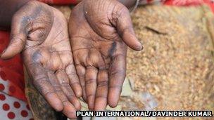 A pair of hands damaged by continuous beedi rolling