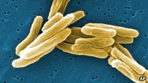 TB bacteria under the microscope