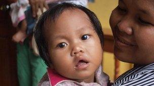 A patient at the Children's Fund Clinic on the outskirts of Phnom Penh