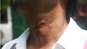 Ismail Rasheed survived several attacks since December 2011 (12 Jul)