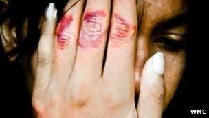 Female abuse victim in Sri Lanka