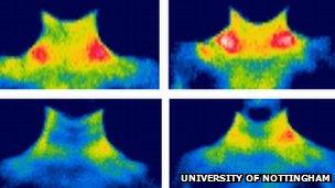 Images showing brown fat in a child