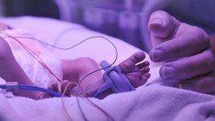 Baby in ICU