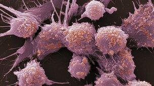 Prostate cancer cells