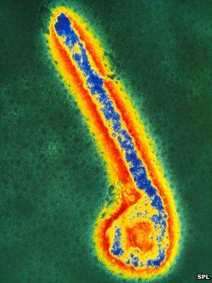 Ebola virus