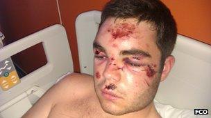 Jake Evans in hospital