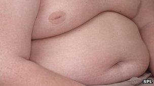 Torso of an obese boy