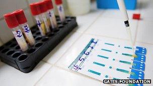 HIV test kit