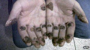 Picture of the hands of Daniel Barrera released by Colombian police on 19 September 2012