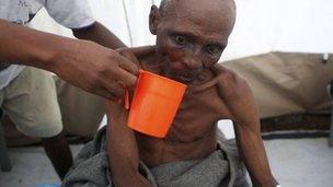 A cholera sufferer is rehydrated in Sierra Leone