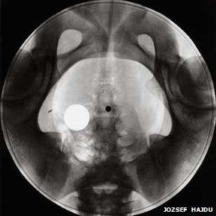 A "disc on bones" - photograph by Jozsef Hajdu, courtesy of Bolt Fotogaleria