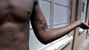 Laventille man's gunshot wound