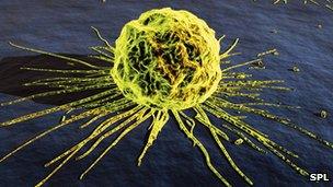 Breast cancer cell