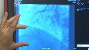 Royal Berkshire heart attack treatment