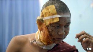 A monk injured in the police crackdown at a Burmese copper mine