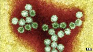 Norovirus