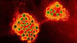 Norovirus