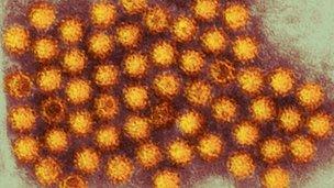 Norovirus particles