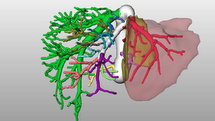 Diagram of part of liver, blood vessels and bile ducts