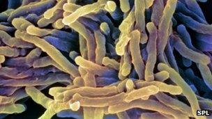 Tuberculosis bacteria