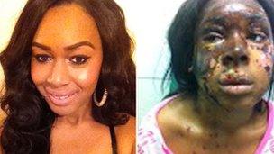 Naomi Oni before and after acid attack