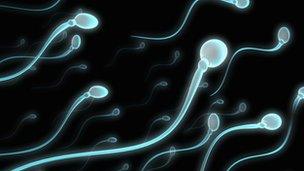 Sperm