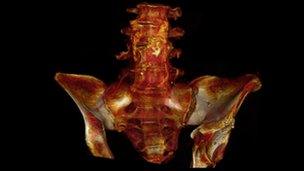 CT scan of mummy