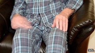 A Parkinson's tremor in man's right hand