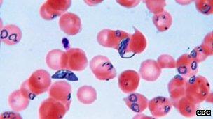 Plasmodium falciparum