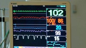 Intensive care unit monitor