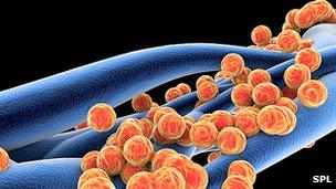 Staphylococcus aureus MRSA bacteria