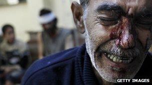 A man cries after his son and daughter died in an attack in Syria