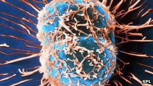 Cervical cancer cells