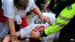 Injured EDL protestor