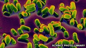 Clusters of the bacteria that cause bubonic plague