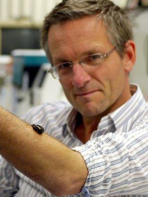 Michael Mosley with leech