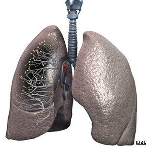 How a pair of lungs look