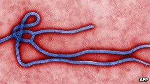 An electron microscope image of the Ebola virus