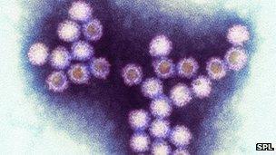 Norovirus