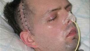 Derry civil servant Paul McCauley after he was beaten up in a sectarian attack in July 2006