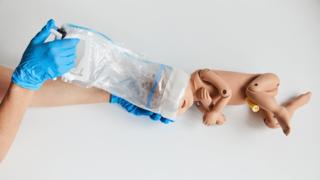 The OdonAssist being used on a baby replica doll. A person wearing blue gloves is using the device which has a plastic handle with a soft plastic extension which is sitting around the baby's head.