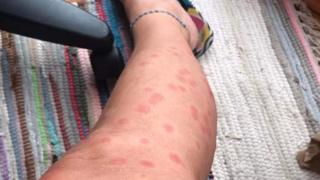 Residents being bugged by biting insect swarms in Lincolnshire village ...