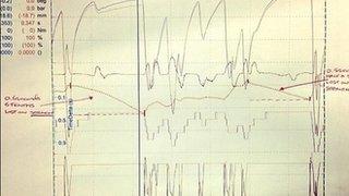 McLaren telemetry shot