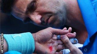 A trainer treats Rafael Nadal's hand