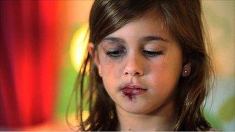 Model of a child from a tv ad aimed at reducing abuse